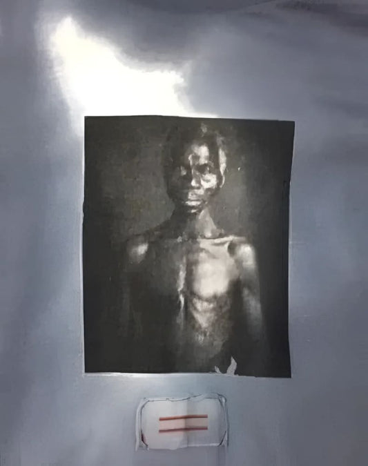 Emaciated man’s portrait.